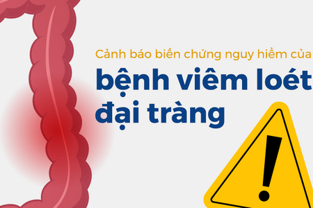 Cảnh báo biến chứng nguy hiểm của bệnh viêm loét đại tràng