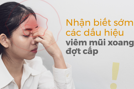 Nhận biết sớm các dấu hiệu viêm mũi xoang đợt cấp