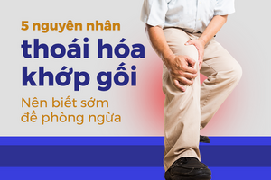 5 nguyên nhân thoái hóa khớp gối: Nên biết sớm để phòng ngừa