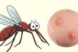 Gợi ý cho mẹ: 5 cách làm dịu da bé khi bị muỗi đốt