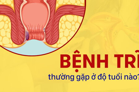 Giải đáp: Bệnh trĩ thường gặp ở độ tuổi nào?