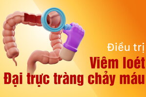 Viêm loét đại trực tràng chảy máu có nguy hiểm không?