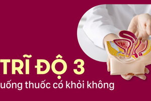 Tư vấn: Trĩ độ 3 uống thuốc có khỏi không?