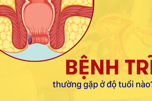 Giải đáp: Bệnh trĩ thường gặp ở độ tuổi nào?