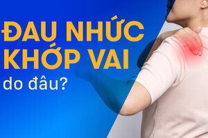 Đau nhức khớp vai do đâu? Giải pháp đơn giản mà hiệu quả