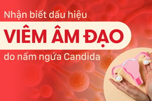 Dấu hiệu nhận biết viêm âm đạo do nấm ngứa Candida