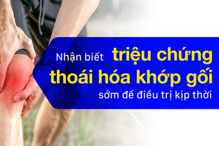 Nhận biết triệu chứng thoái hóa khớp gối sớm để điều trị kịp thời