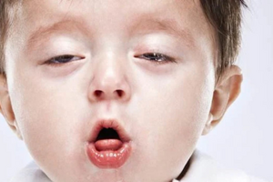 TPHCM ghi nhận ca đầu tiên mắc bệnh ho gà trong năm