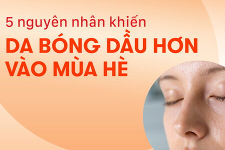5 nguyên nhân khiến da bóng dầu hơn vào mùa hè