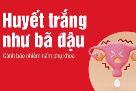 Huyết trắng vón cục như bã đậu: Cảnh báo nhiễm nấm phụ khoa