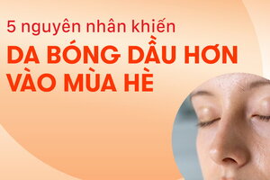 5 nguyên nhân khiến da bóng dầu hơn vào mùa hè