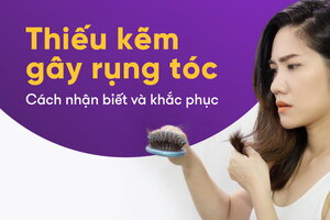 Thiếu kẽm gây rụng tóc – Cách nhận biết và khắc phục