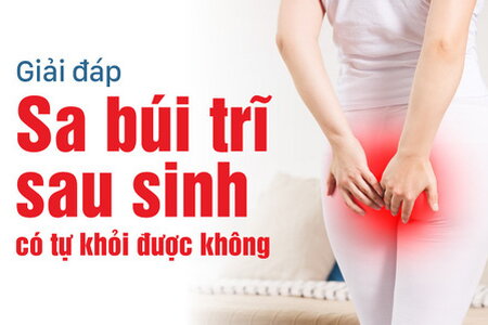 Giải đáp: Sa búi trĩ sau sinh có tự khỏi được không?