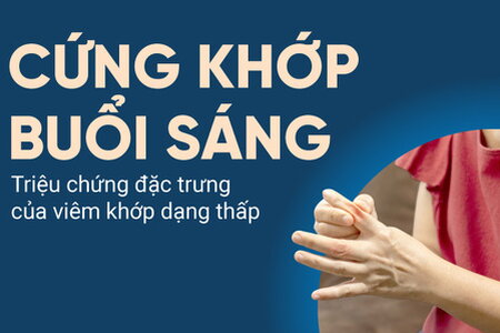 Cứng khớp buổi sáng – Triệu chứng đặc trưng của viêm khớp dạng thấp