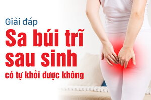 Giải đáp: Sa búi trĩ sau sinh có tự khỏi được không?