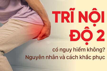 Trĩ nội độ 2 có nguy hiểm không? Nguyên nhân và cách khắc phục 