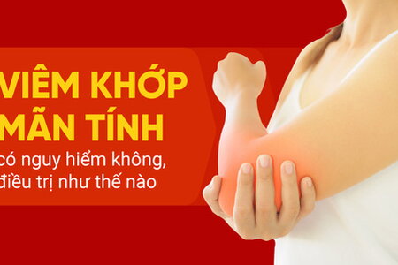 Viêm khớp mãn tính có nguy hiểm không, điều trị như thế nào?