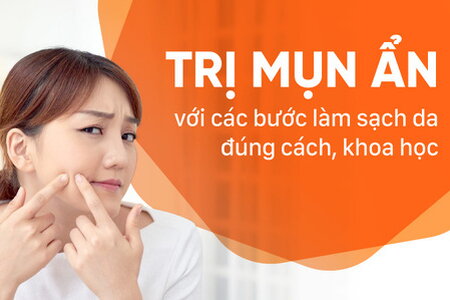 Trị mụn ẩn với các bước làm sạch da đúng cách, khoa học