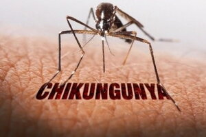 Chikungunya là bệnh gì và khác sốt xuất huyết ra sao?