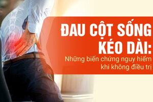 Đau cột sống kéo dài: Những biến chứng nguy hiểm khi không điều trị