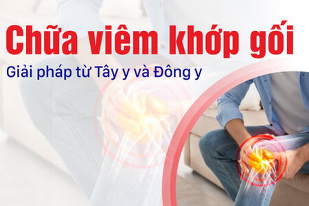 Chữa viêm khớp gối: Giải pháp từ Tây y và Đông y
