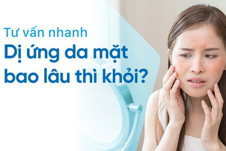 Tư vấn nhanh: Dị ứng da mặt bao lâu thì khỏi?