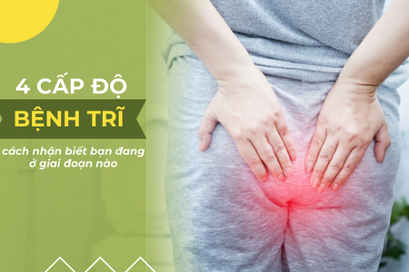 4 cấp độ bệnh trĩ – Cách nhận biết bạn đang ở giai đoạn nào