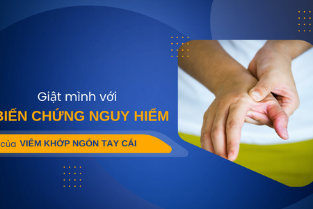 Giật mình với biến chứng nguy hiểm của viêm khớp ngón tay cái