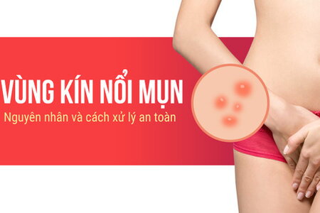 Vùng kín nổi mụn: Nguyên nhân và cách xử lý an toàn