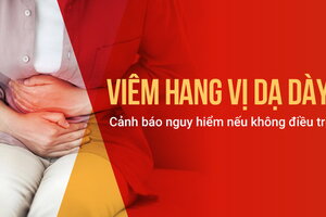 Viêm hang vị dạ dày: Cảnh báo nguy hiểm nếu không điều trị