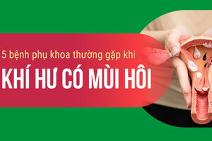 5 bệnh phụ khoa thường gặp khi khí hư có mùi hôi