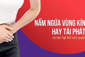 Nấm ngứa vùng kín hay tái phát và tác hại khi chủ quan