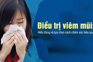 Điều trị viêm mũi: Hiểu đúng và lựa chọn cách chăm sóc hiệu quả