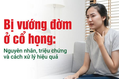 Bị vướng đờm ở cổ họng: Nguyên nhân, triệu chứng và cách xử lý