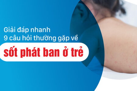 Giải đáp nhanh 9 câu hỏi thường gặp về sốt phát ban ở trẻ