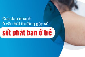 Giải đáp nhanh 9 câu hỏi thường gặp về sốt phát ban ở trẻ