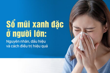 Sổ mũi xanh đặc ở người lớn: Nguyên nhân, dấu hiệu và cách điều trị