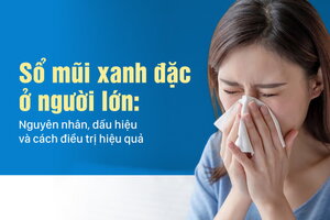 Sổ mũi xanh đặc ở người lớn: Nguyên nhân, dấu hiệu và cách điều trị