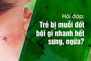 Hỏi đáp: Trẻ bị muỗi đốt bôi gì nhanh hết sưng, ngứa?