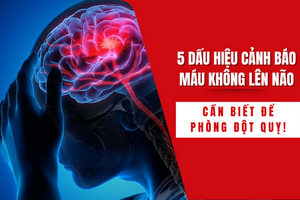 5 dấu hiệu cảnh báo máu không lên não – cần biết để phòng đột quỵ!