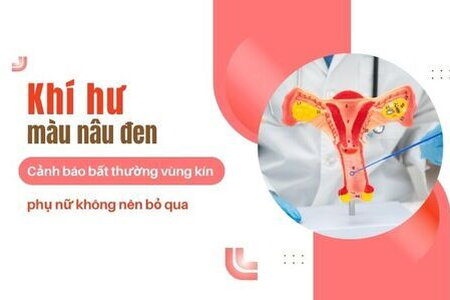 Khí hư màu nâu đen – Cảnh báo bất thường vùng kín