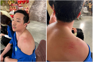 Trấn Thành đăng ảnh đầy thương tích gây lo lắng