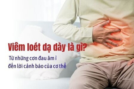 Viêm loét dạ dày là gì? Từ những cơn đau âm ỉ đến lời cảnh báo