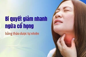 Bí quyết giảm nhanh ngứa cổ họng bằng thảo dược tự nhiên