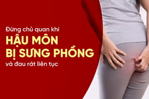 Đừng chủ quan khi hậu môn bị sưng phồng và đau rát liên tục