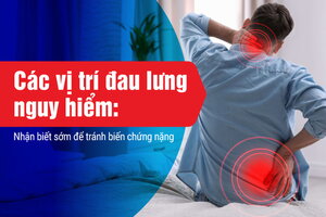 Các vị trí đau lưng nguy hiểm: Nhận biết sớm để tránh biến chứng nặng