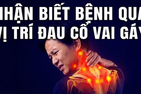 Nhận biết bệnh qua vị trí đau cổ vai gáy