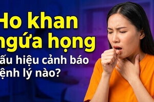 Ho khan ngứa họng: dấu hiệu cảnh báo bệnh lý nào?