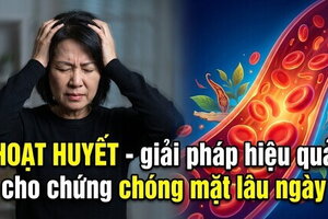 Hoạt huyết - giải pháp hiệu quả cho chứng chóng mặt lâu ngày