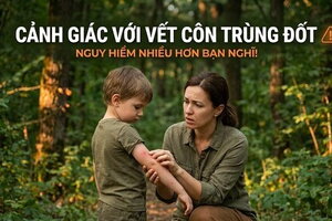 Cảnh giác với vết côn trùng đốt: nguy hiểm nhiều hơn bạn nghĩ!
